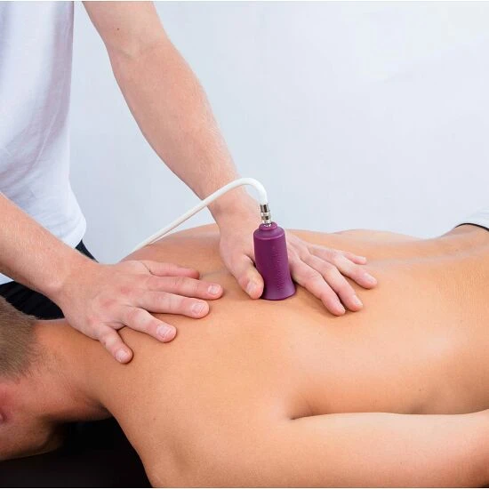 BellaBambi Schröpfsauger-Set "Multi" 2 BellaBambi Schröpfsauger-Set "Multi" – Bild 2